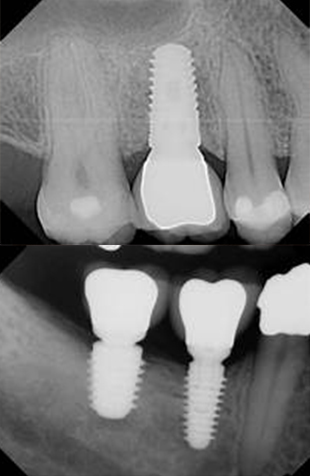 digital x rays