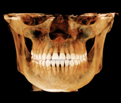 i cat flx 3d imaging